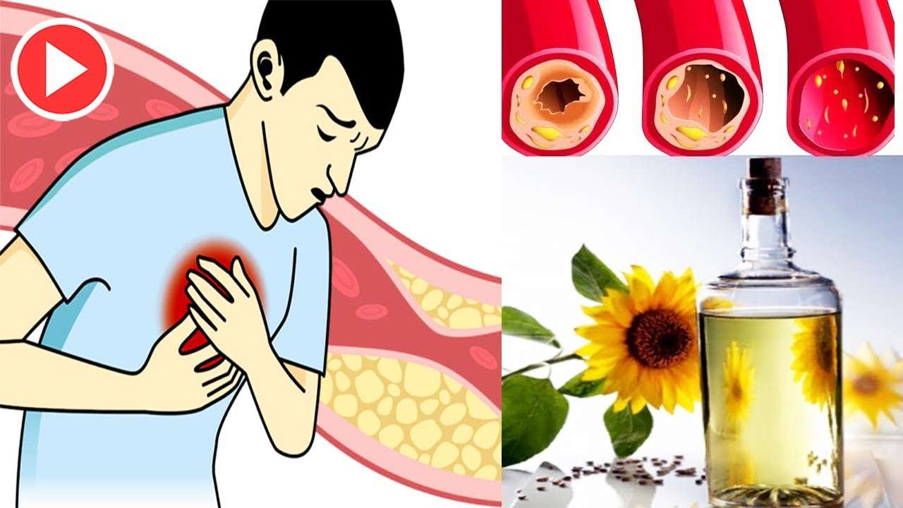 5 Magical Drink To Reduce Cholesterol In 2 Weeks Naturally