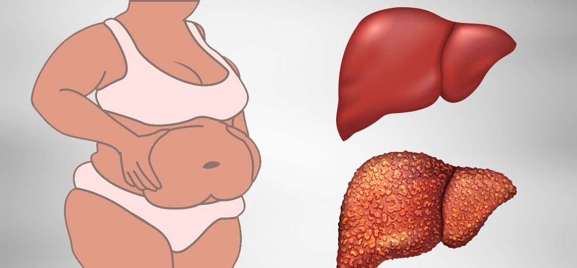 6 SIGNS THAT YOUR LIVER IS FULL OF TOXINS AND MAKING YOU ...