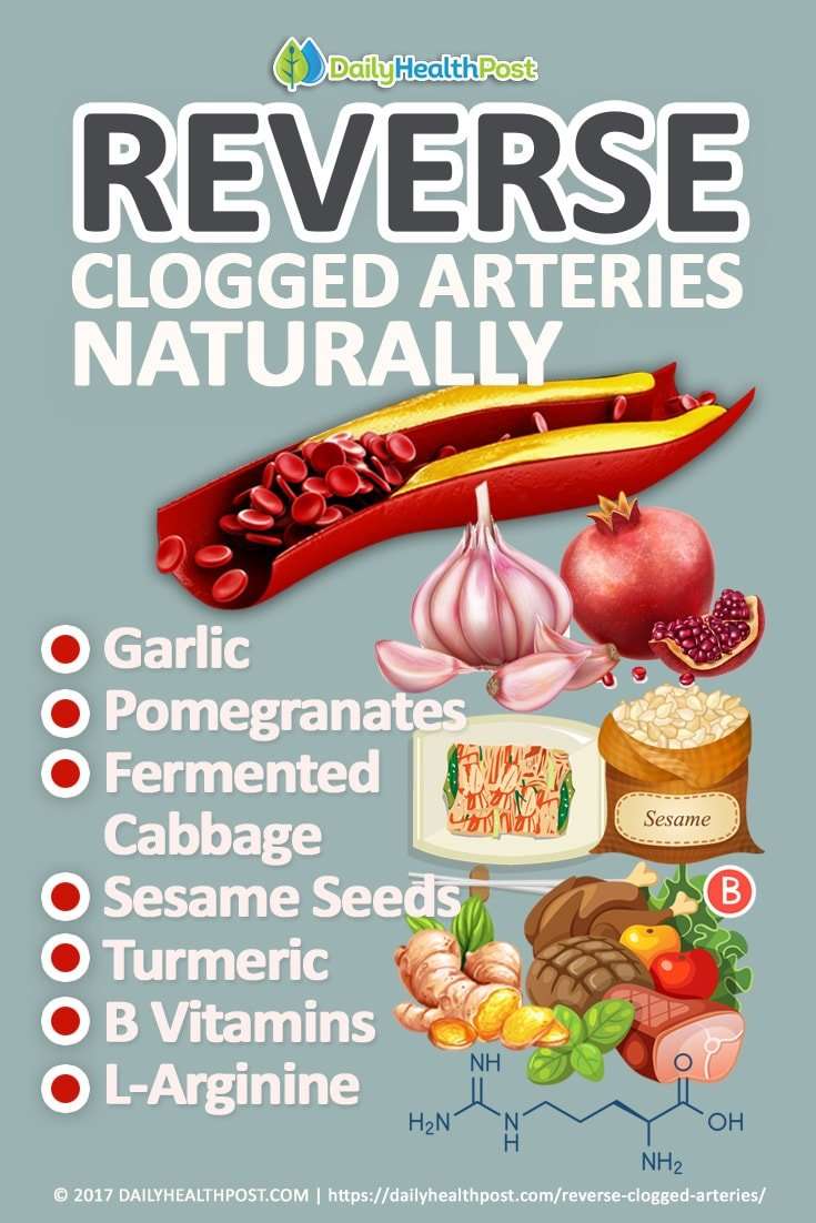 7 Simple Ways To Reverse Clogged Arteries Naturally