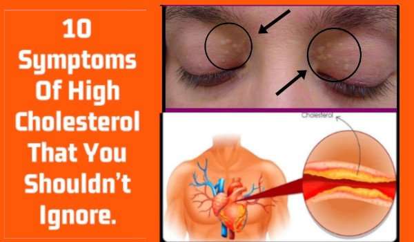 9 Symptoms Of High Cholesterol that You Shouldnt Ignore!