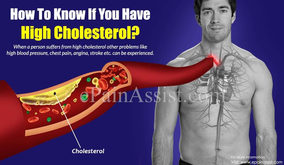 Causes of High Cholesterol &  How To Know If You Have High Cholesterol?