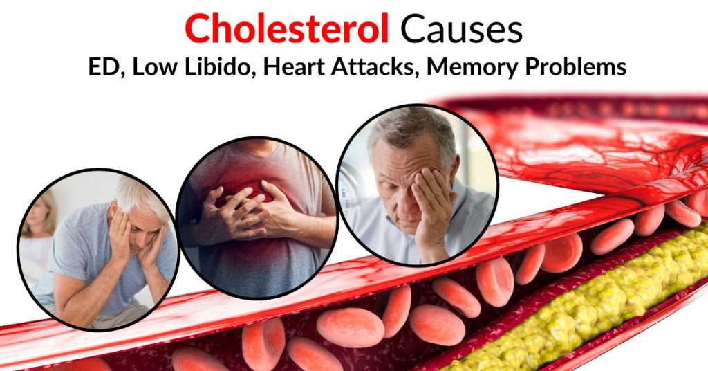 Cholesterol Causes ED, Low Libido, Heart Attacks, Memory ...