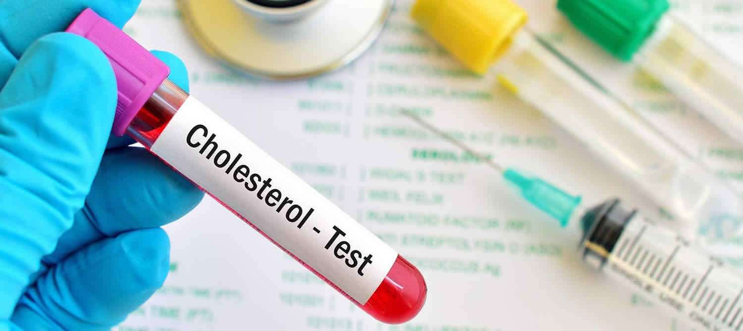 Cholesterol test prep, fasting, what do the results of ...