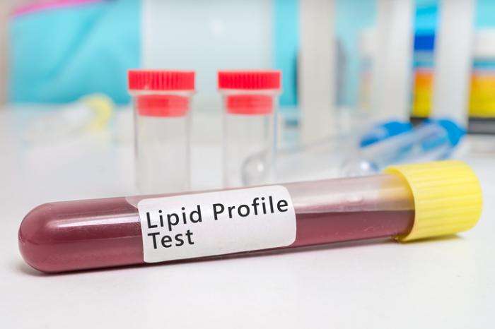 Cholesterol test: Uses, what to expect, results