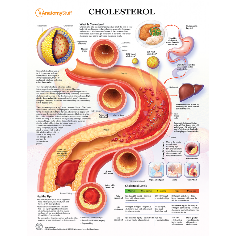 Cholesterol Understanding LDL &  HDL Chart Poster Laminated ...