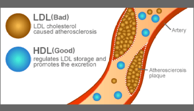 Cholesterol: Weve Been Wrong All Along