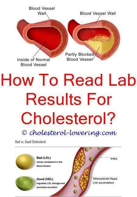 cholesterolnormalrange how do you treat high ldl ...