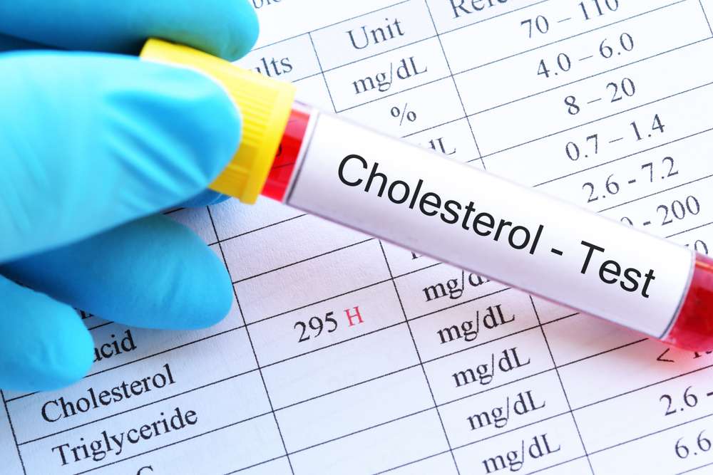 Counting Cholesterol: How Often Should You Check Your Levels?