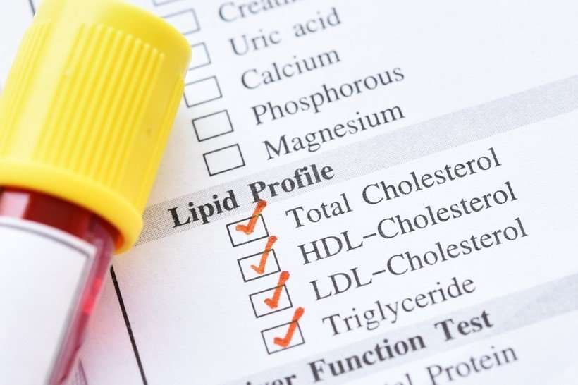 Do I need to prepare for a cholesterol test?