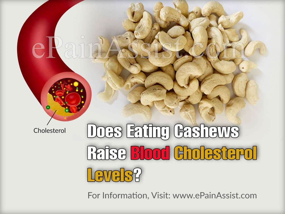 Does Eating Cashews Raise Blood Cholesterol Levels?