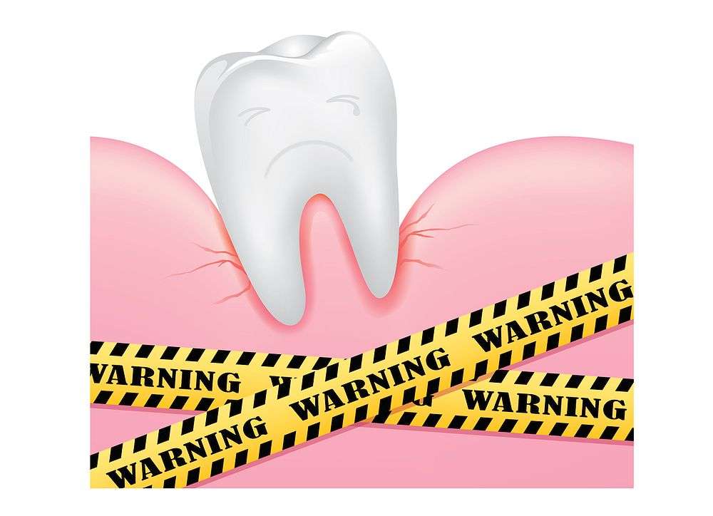 Does High Cholesterol Level Leads to Loose Teeth?