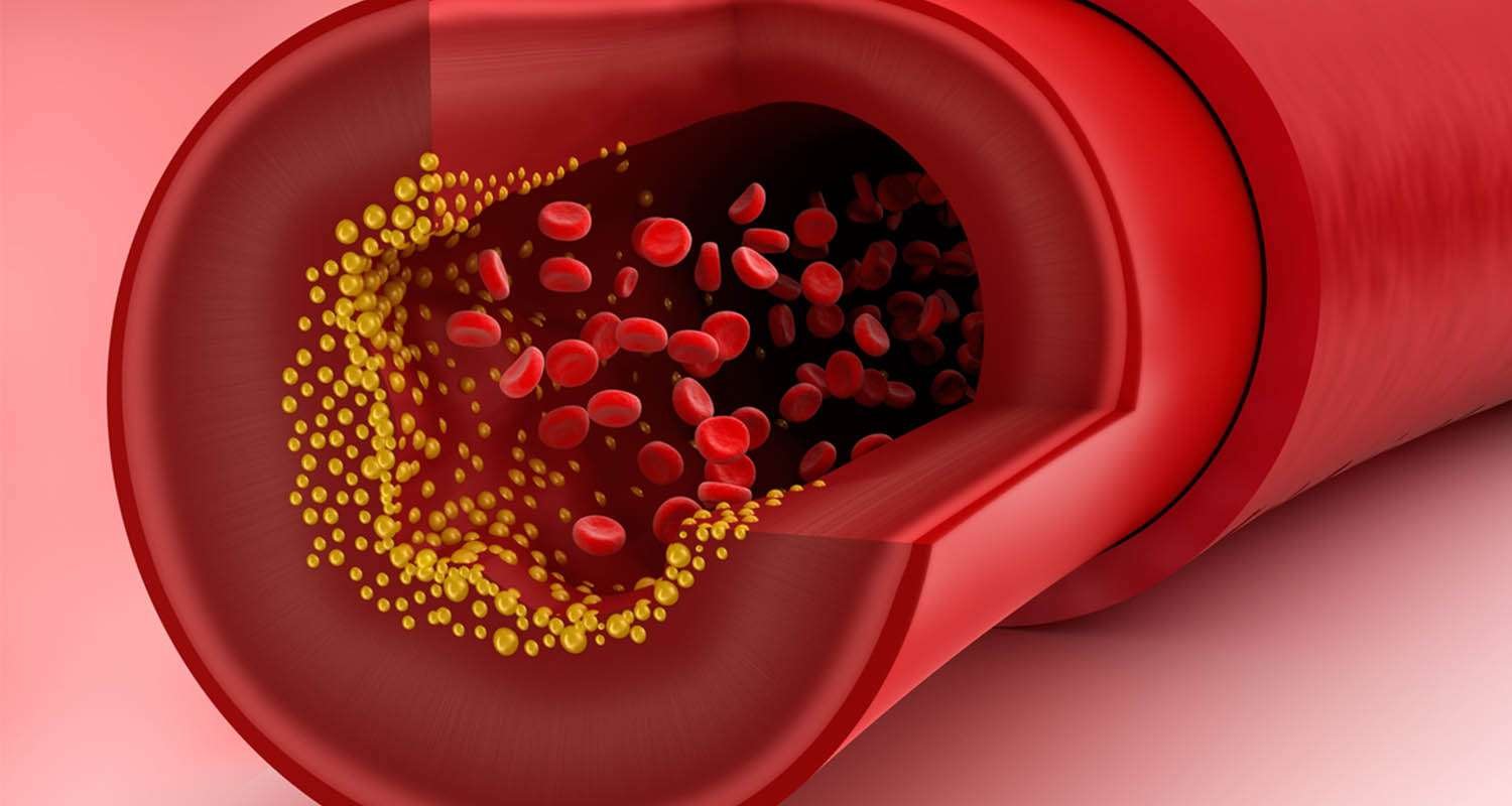 Everything You Know About Cholesterol Is Wrong