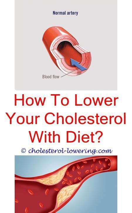 #hdlcholesterollow can you see cholesterol in your eyes ...