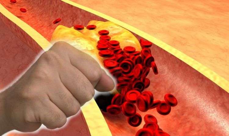 High cholesterol: Hidden warning signs levels are ...