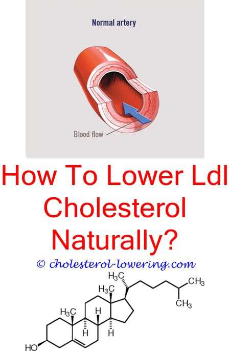 High Cholesterol Numbers