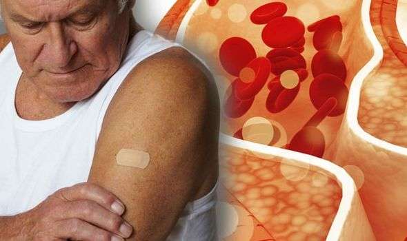High cholesterol: Pain in arms is a sign that your levels ...