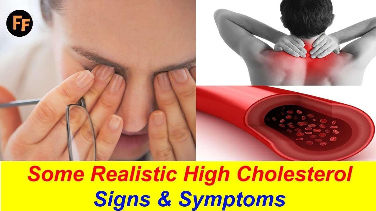 High Cholesterol Signs &  Symptoms
