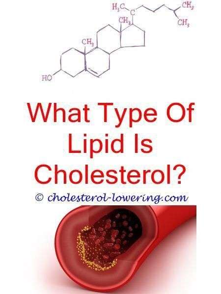 highcholesterol does high cholesterol cause vertigo?