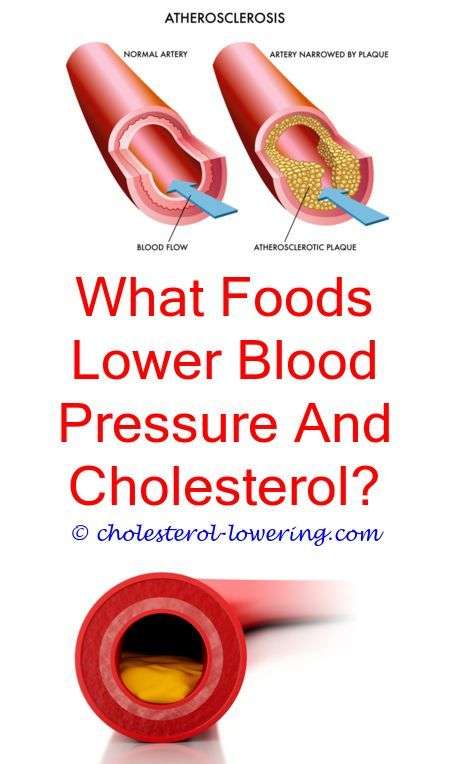 #highcholesteroldiet do bile salts excrete cholesterol?