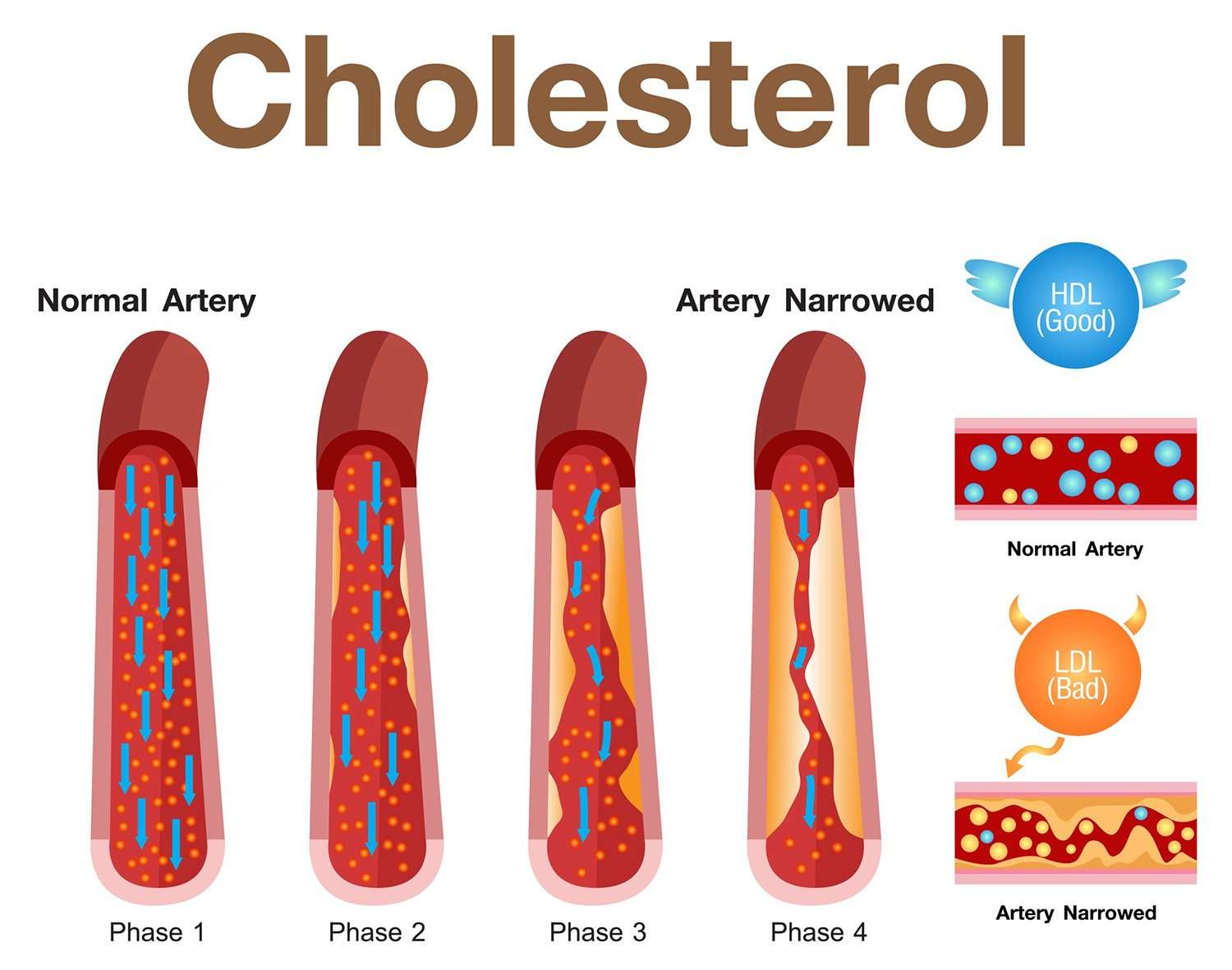 How to Calculate Total Cholesterol.