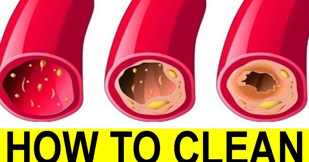 How to Clean Cholesterol Residue From Blood Vessels In 40 days