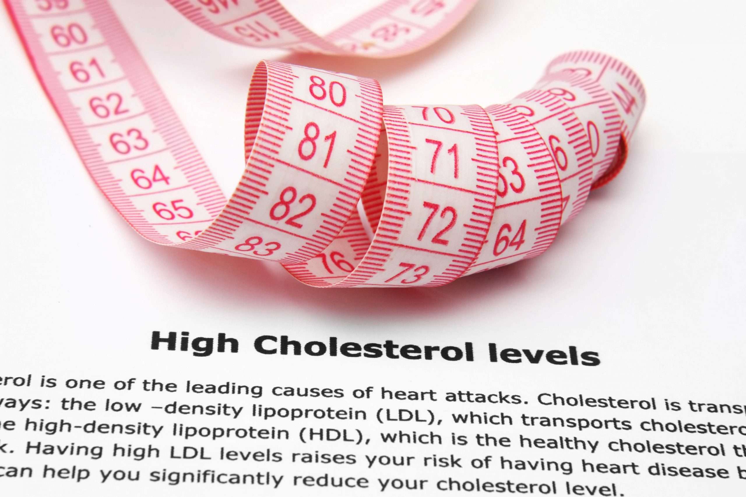 How to Know If You Have High Cholesterol