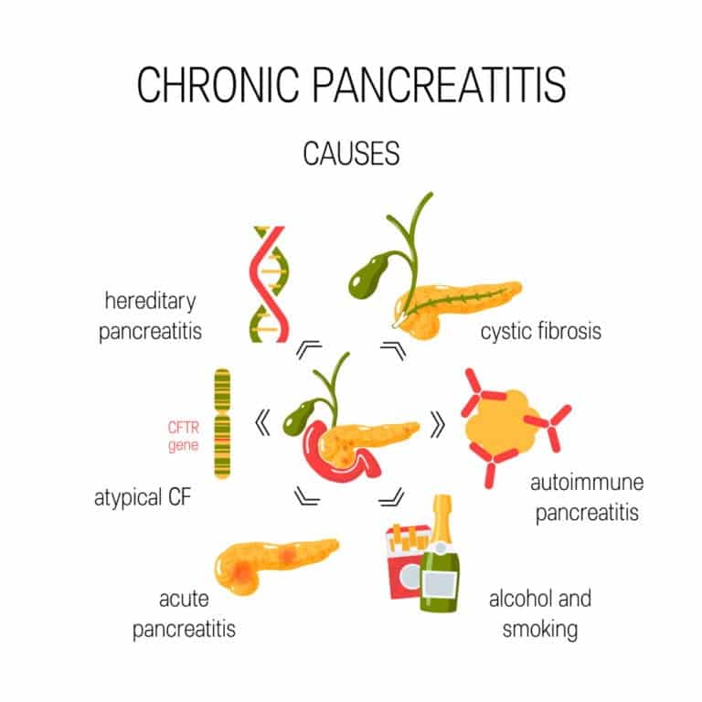 Life Expectancy of Chronic Pancreatitis with Causes and Symptoms