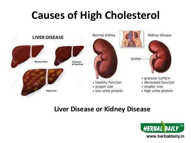 Liver Disease Causes High Cholesterol