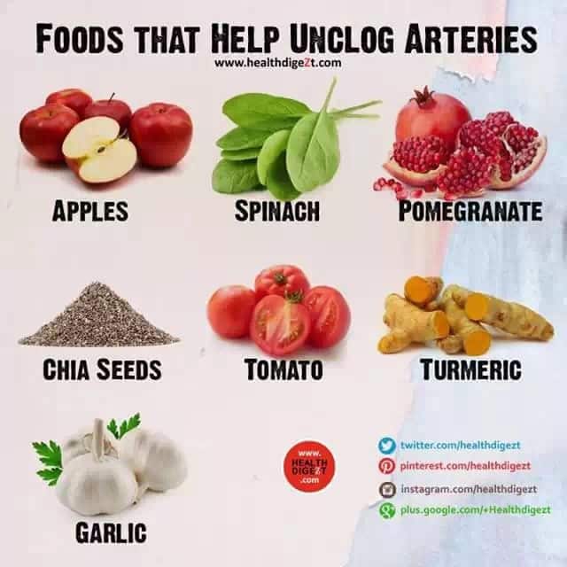 Pin by Irene on Triglycerides, cholesterol and clogged arteries ...