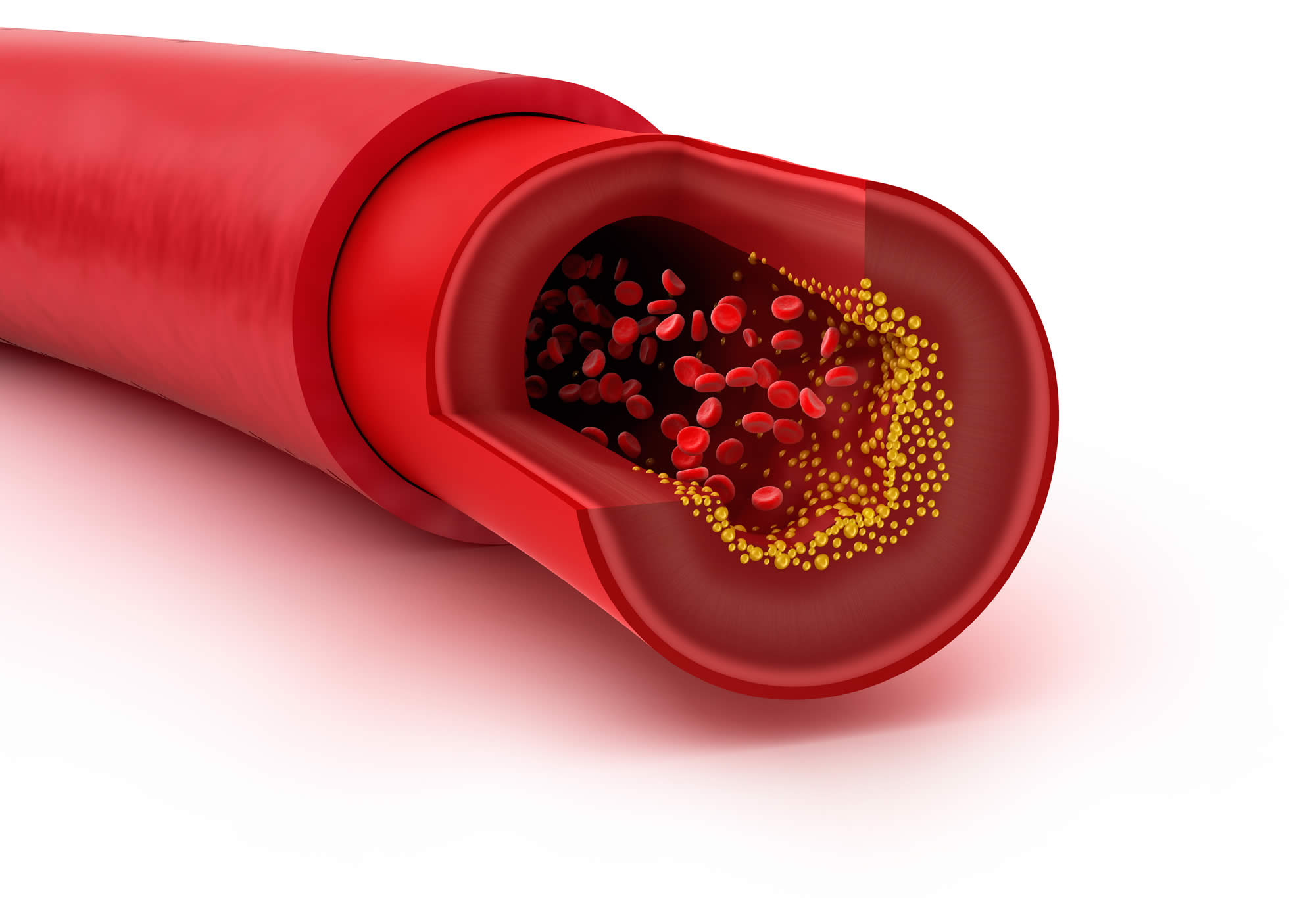 Recent Updates on Cholesterol Treatment