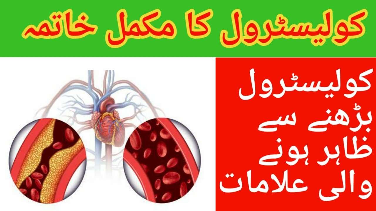 Signs and symptoms of high cholesterol / how to get rid of ...