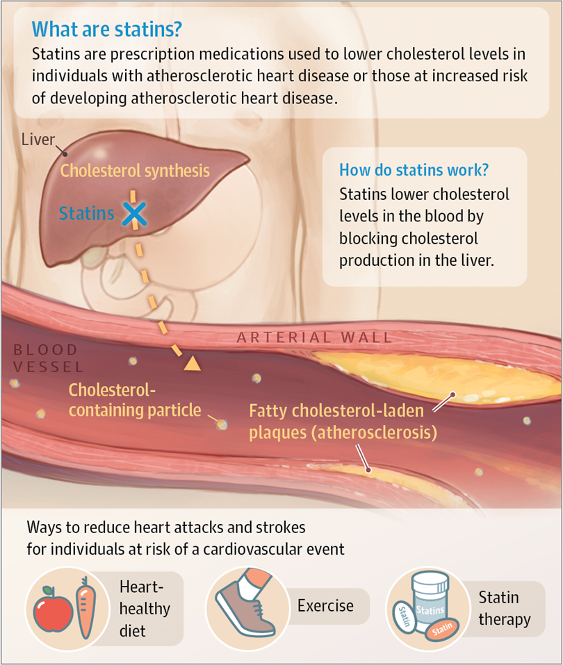 Statins and the Prevention of Heart Disease.