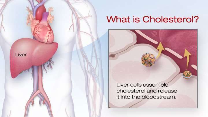 Too much cholesterol in our blood is termed ...
