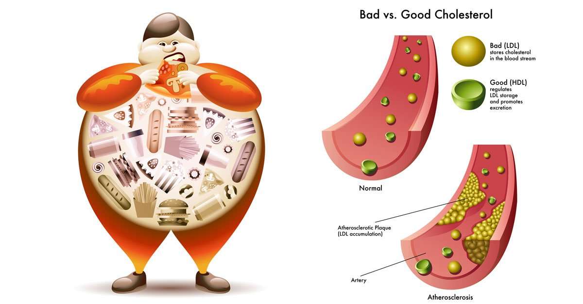 Total Cholesterol Overview