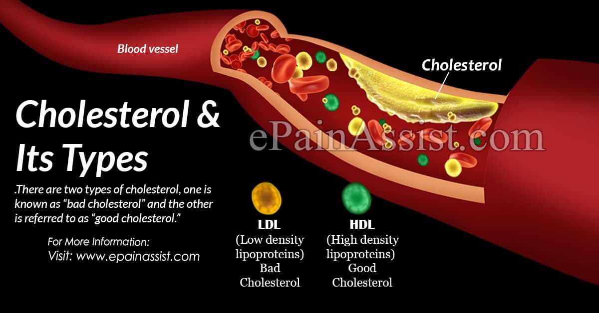 Types of Cholesterol, Its Causes, Symptoms, Treatment ...
