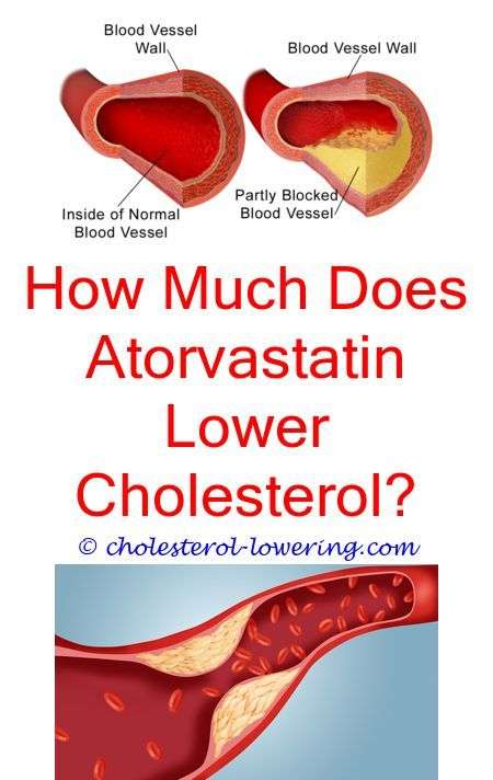 Vitamin D Cholesterol