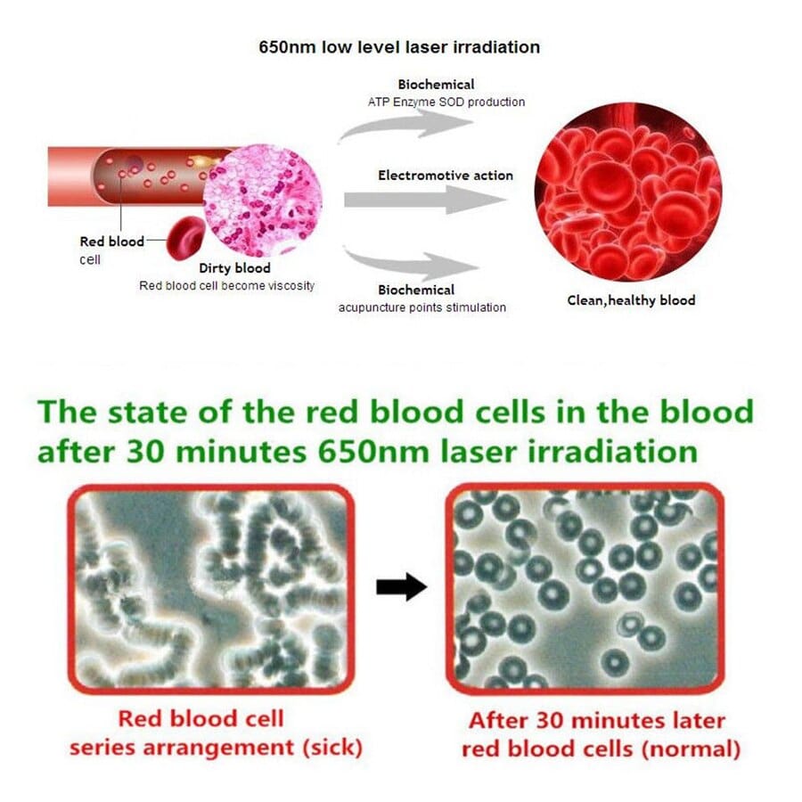 what causes fat in blood and how to reduce?red led light laser therapy ...