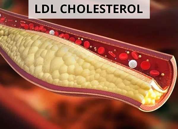 What is the Desirable LDL Bad Cholesterol Level