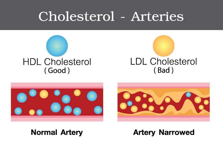 Which cholesterol is considered good  Health Blog