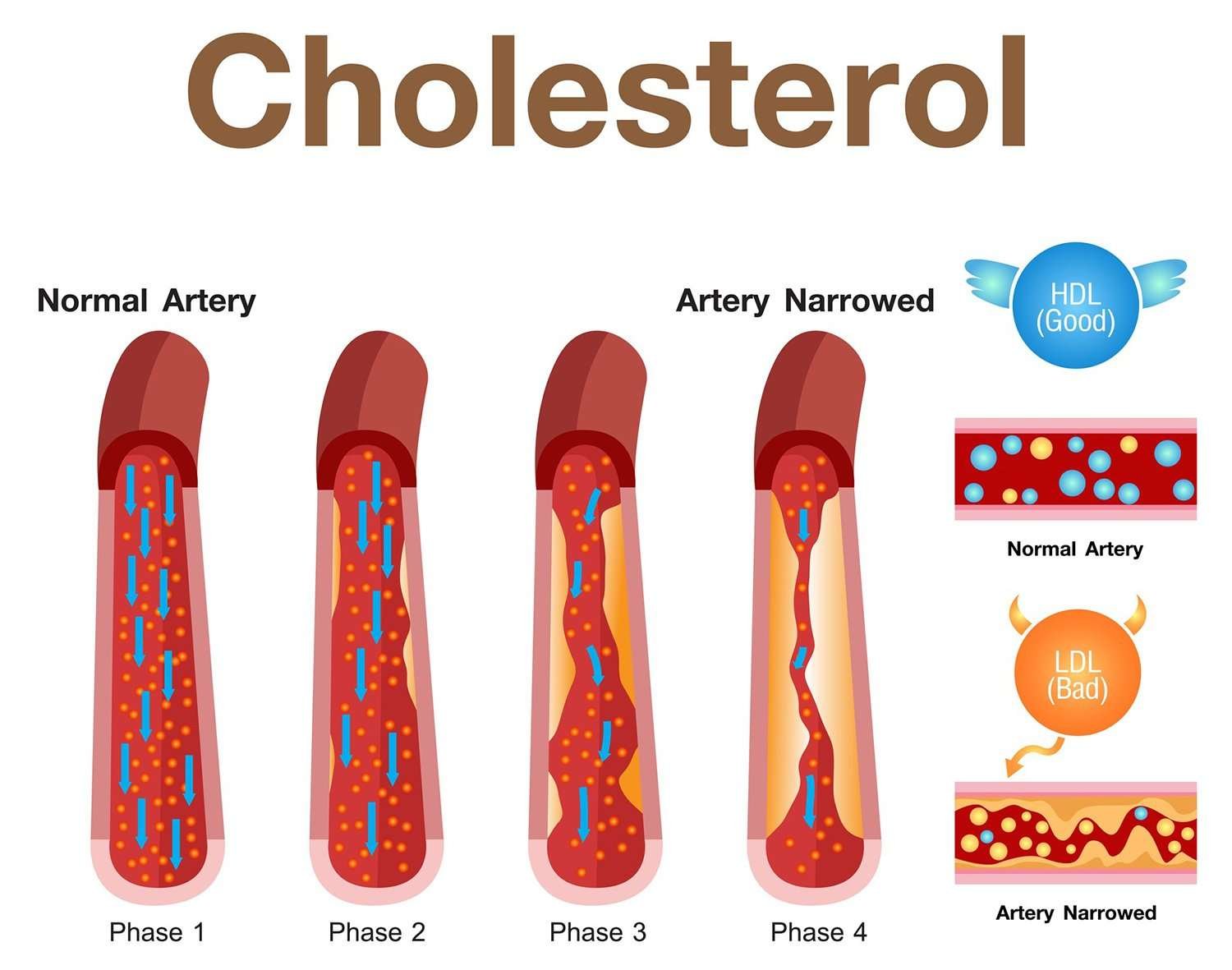 Which is good cholesterol? LDL or HDL?